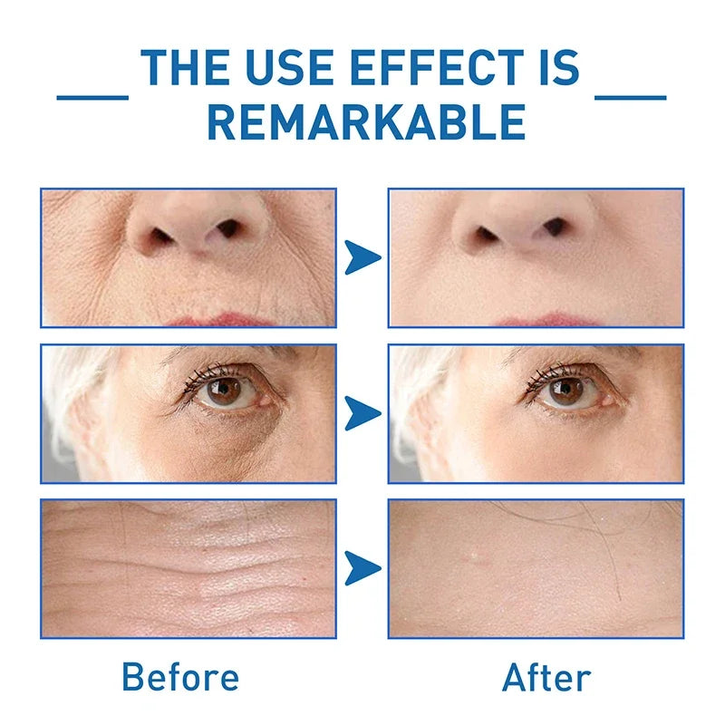Pure Hyaluronic Acid Facial Serum Anti Wrinkle Aging Face Lift Tightening Reduce Eye Finelines Moisturizing Cosmetics NEW